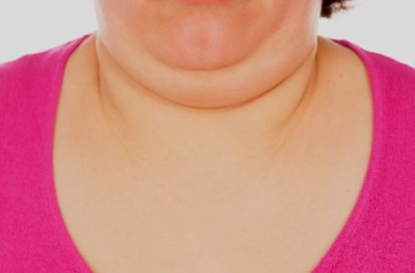 Malu Sebab Ada Double Chin? Ini 4 Cara Untuk Hilangkannya